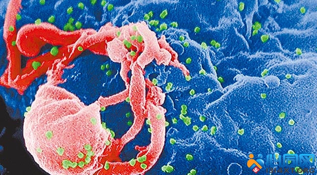 日本HIV感染者 73%为同性性接触