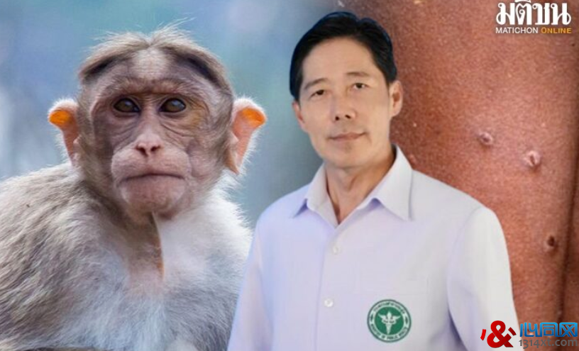 泰国泼水节结束三天 台湾猴痘病例暴增创单周新高！